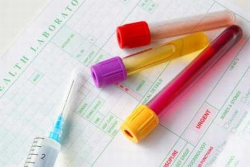 Alla guida e positivo al test tossicologico: assolto dopo tre anni